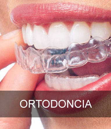 Ortodoncia | Dentista de confianza en San Sebastián de los Reyes Durident Madrid